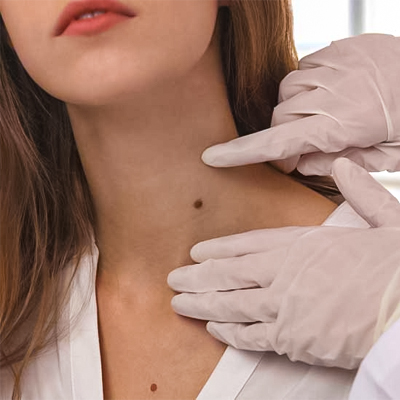 salivary gland cancer treatment