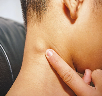 neck swelling treatment
