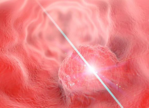 head and neck cancer treatment
